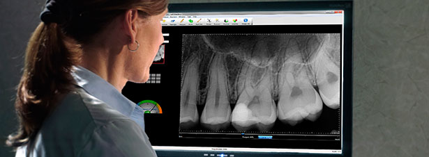 Photo of intraoral dental radiograph